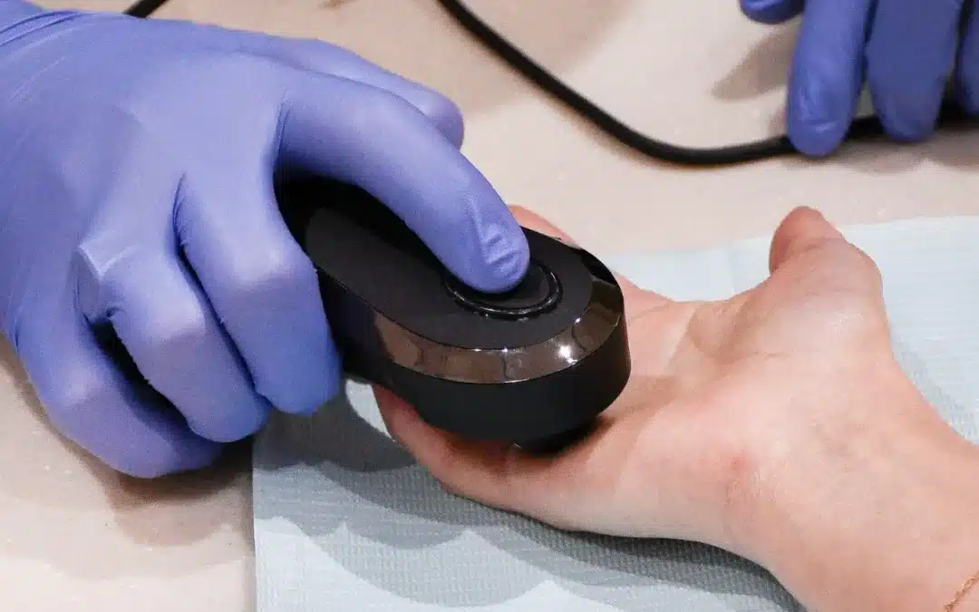 Practitioner performing OligoScan mineral test on a patient's hand at MyThrivelytics Rockville MD